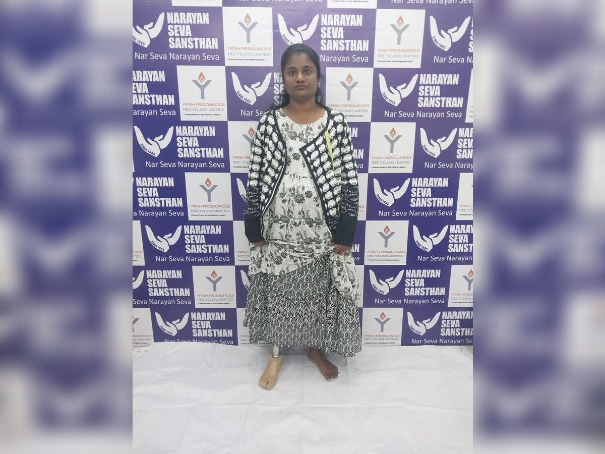 Narayan Seva Sansthan & Yash Resources Restore Mobility for 100 Persons with Disabilities 